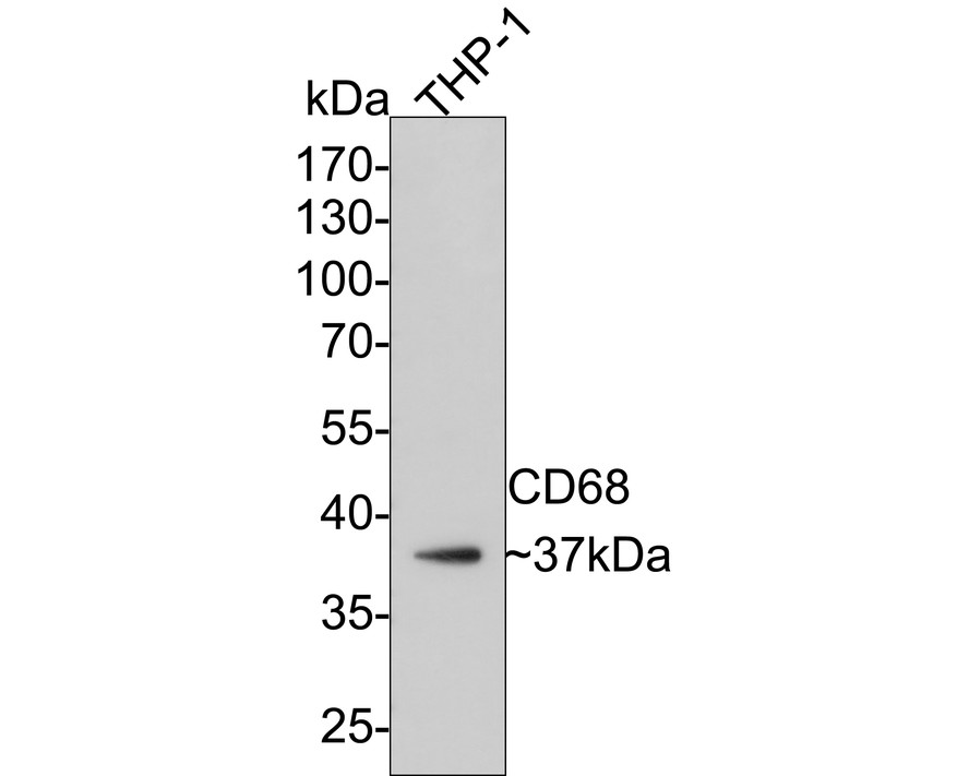 Western blot analysis of CD68 on THP-1 cell lysates with Rabbit anti-CD68 antibody (ET1611-53) at 1/500 dilution.<br />
<br />
Lysates/proteins at 10 µg/Lane.<br />
<br />
Predicted band size: 37 kDa<br />
Observed band size: 37 kDa<br />
<br />
Exposure time: 2 minutes;<br />
<br />
10% SDS-PAGE gel.<br />
<br />
Proteins were transferred to a PVDF membrane and blocked with 5% NFDM/TBST for 1 hour at room temperature. The primary antibody (ET1611-53) at 1/500 dilution was used in 5% NFDM/TBST at room temperature for 2 hours. Goat Anti-Rabbit IgG - HRP Secondary Antibody (HA1001) at 1:300,000 dilution was used for 1 hour at room temperature.