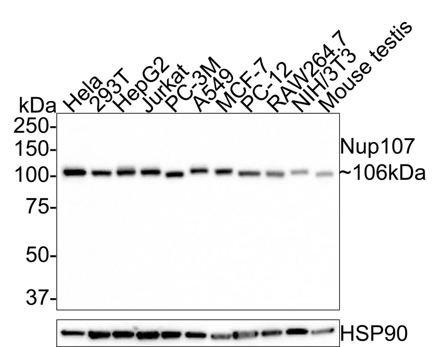 Western blot analysis of Nup107 on different lysates with Rabbit anti-Nup107 antibody (HA500521) at 1/1,000 dilution.<br />
<br />
Lane 1: Hela cell lysate (20 µg/Lane)<br />
Lane 2: 293T cell lysate (20 µg/Lane)<br />
Lane 3: HepG2 cell lysate (20 µg/Lane)<br />
Lane 4: Jurkat cell lysate (20 µg/Lane)<br />
Lane 5: PC-3M cell lysate (20 µg/Lane)<br />
Lane 6: A549 cell lysate (20 µg/Lane)<br />
Lane 7: MCF-7 cell lysate (20 µg/Lane)<br />
Lane 8: PC-12 cell lysate (20 µg/Lane)<br />
Lane 9: RAW264.7 cell lysate (20 µg/Lane)<br />
Lane 10: NIH/3T3 cell lysate (20 µg/Lane)<br />
Lane 11: Mouse testis tissue lysate (30 µg/Lane)<br />
<br />
Predicted band size: 106 kDa<br />
Observed band size: 106 kDa<br />
<br />
Exposure time: 30 seconds;<br />
<br />
8% SDS-PAGE gel.<br />
<br />
Proteins were transferred to a PVDF membrane and blocked with 5% NFDM/TBST for 1 hour at room temperature. The primary antibody (HA500521) at 1/1,000 dilution was used in 5% NFDM/TBST at room temperature for 2 hours. Goat Anti-Rabbit IgG - HRP Secondary Antibody (HA1001) at 1:300,000 dilution was used for 1 hour at room temperature.