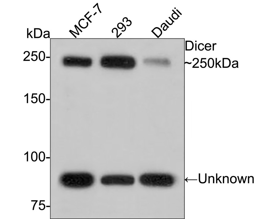 Western blot analysis of Dicer on different lysates with Rabbit anti-Dicer antibody (HA500522) at 1/1,000 dilution.<br />
<br />
Lane 1: MCF-7 cell lysate<br />
Lane 2: 293 cell lysate<br />
Lane 3: Daudi cell lysate<br />
<br />
Lysates/proteins at 10 µg/Lane.<br />
<br />
Predicted band size: 218 kDa<br />
Observed band size: 250 kDa<br />
<br />
Exposure time: 2 minutes;<br />
<br />
6% SDS-PAGE gel.<br />
<br />
Proteins were transferred to a PVDF membrane and blocked with 5% NFDM/TBST for 1 hour at room temperature. The primary antibody (HA500522) at 1/1,000 dilution was used in 5% NFDM/TBST at room temperature for 2 hours. Goat Anti-Rabbit IgG - HRP Secondary Antibody (HA1001) at 1:300,000 dilution was used for 1 hour at room temperature.