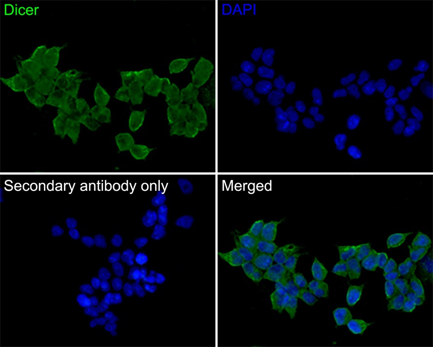 Immunocytochemistry analysis of MCF-7 cells labeling Dicer with Rabbit anti-Dicer antibody (HA500522) at 10ug/mL dilution.<br />
<br />
Cells were fixed in 4% paraformaldehyde for 10 minutes at 37 ℃, permeabilized with 0.05% Triton X-100 in PBS for 20 minutes, and then blocked with 2% negative goat serum for 30 minutes at room temperature. Cells were then incubated with Rabbit anti-Dicer antibody (HA500522) at 10ug/mL dilution in 2% negative goat serum overnight at 4 ℃. Goat Anti-Rabbit IgG H&L (iFluor™ 488, HA1121) was used as the secondary antibody at 1/1,000 dilution. PBS instead of the primary antibody was used as the secondary antibody only control. Nuclear DNA was labelled in blue with DAPI.