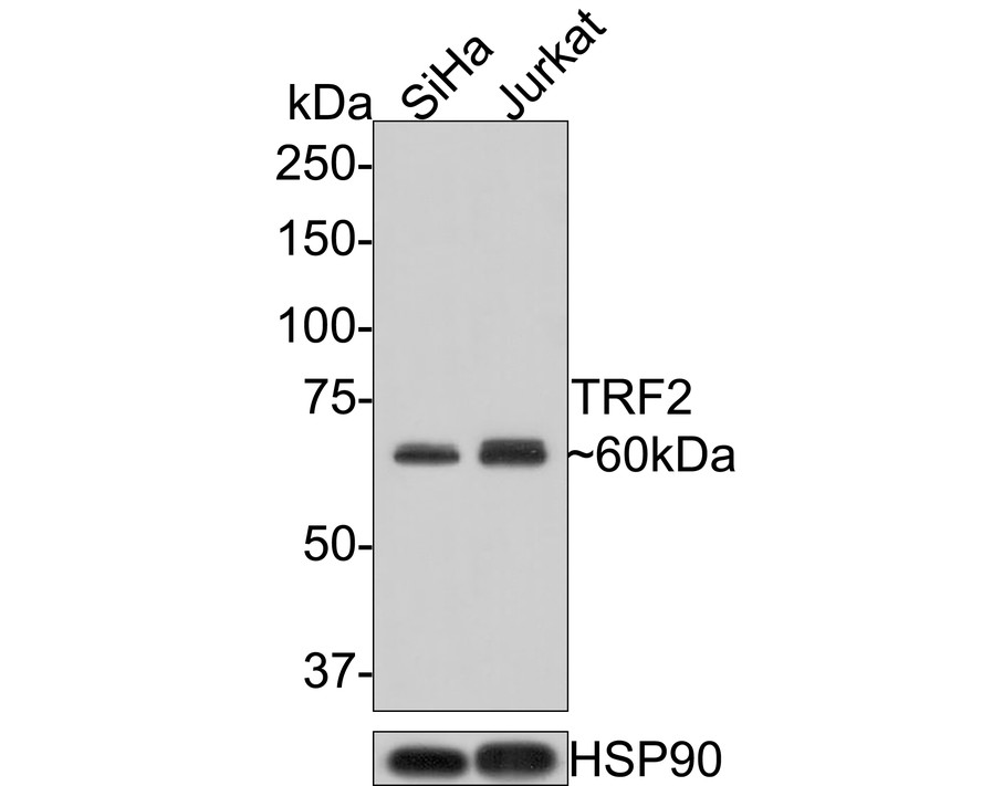 Western blot analysis of TRF2 on different lysates with Rabbit anti-TRF2 antibody (HA721297) at 1/500 dilution.<br />
<br />
Lane 1: SiHa cell lysate<br />
Lane 2: Jurkat cell lysate<br />
<br />
Lysates/proteins at 10 µg/Lane.<br />
<br />
Predicted band size: 60 kDa<br />
Observed band size: 60 kDa<br />
<br />
Exposure time: 2 minutes;<br />
<br />
10% SDS-PAGE gel.<br />
<br />
Proteins were transferred to a PVDF membrane and blocked with 5% NFDM/TBST for 1 hour at room temperature. The primary antibody (HA721297) at 1/500 dilution was used in 5% NFDM/TBST at room temperature for 2 hours. Goat Anti-Rabbit IgG - HRP Secondary Antibody (HA1001) at 1:200,000 dilution was used for 1 hour at room temperature.