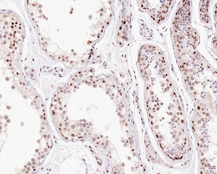 Immunohistochemical analysis of paraffin-embedded human testis tissue with Rabbit anti-TRF2 antibody (HA721297) at 1/200 dilution.<br />
<br />
The section was pre-treated using heat mediated antigen retrieval with sodium citrate buffer (pH 6.0) for 2 minutes. The tissues were blocked in 1% BSA for 20 minutes at room temperature, washed with ddH2O and PBS, and then probed with the primary antibody (HA721297) at 1/200 dilution for 1 hour at room temperature. The detection was performed using an HRP conjugated compact polymer system. DAB was used as the chromogen. Tissues were counterstained with hematoxylin and mounted with DPX.