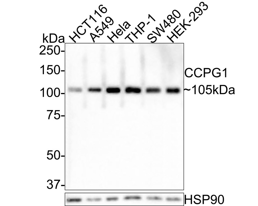 Western blot analysis of CCPG1 on different lysates with Rabbit anti-CCPG1 antibody (HA500520) at 1/1,000 dilution.<br />
<br />
Lane 1: HCT116 cell lysate<br />
Lane 2: A549 cell lysate<br />
Lane 3: Hela cell lysate<br />
Lane 4: THP-1 cell lysate<br />
Lane 5: SW480 cell lysate<br />
Lane 6: HEK-293 cell lysate<br />
<br />
Lysates/proteins at 30 µg/Lane.<br />
<br />
Predicted band size: 87 kDa<br />
Observed band size: 105 kDa<br />
<br />
Exposure time: 2 minutes;<br />
<br />
8% SDS-PAGE gel.<br />
<br />
Proteins were transferred to a PVDF membrane and blocked with 5% NFDM/TBST for 1 hour at room temperature. The primary antibody (HA500520) at 1/1,000 dilution was used in 5% NFDM/TBST at room temperature for 2 hours. Goat Anti-Rabbit IgG - HRP Secondary Antibody (HA1001) at 1:300,000 dilution was used for 1 hour at room temperature.