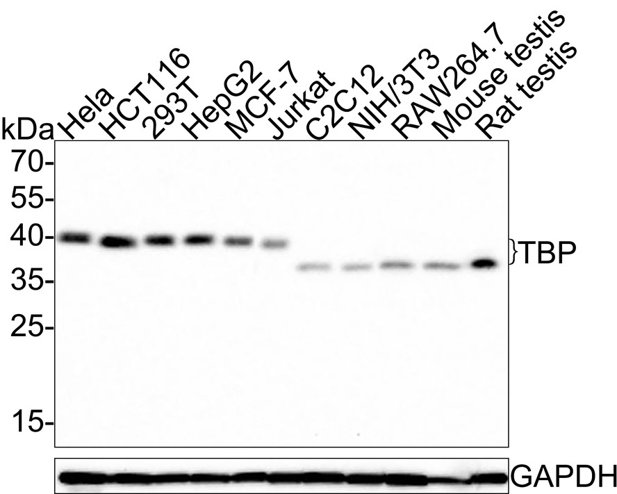 Western blot analysis of TATA binding protein TBP on different lysates with Rabbit anti-TATA binding protein TBP antibody (HA500518) at 1/1,000 dilution.<br />
<br />
Lane 1: Hela cell lysate (20 µg/Lane)<br />
Lane 2: HCT116 cell lysate (20 µg/Lane)<br />
Lane 3: 293T cell lysate (20 µg/Lane)<br />
Lane 4: HepG2 cell lysate (20 µg/Lane)<br />
Lane 5: MCF-7 cell lysate (20 µg/Lane)<br />
Lane 6: Jurkat cell lysate (20 µg/Lane)<br />
Lane 7: C2C12 cell lysate (20 µg/Lane)<br />
Lane 8: NIH/3T3 cell lysate (20 µg/Lane)<br />
Lane 9: RAW264.7 cell lysate (20 µg/Lane)<br />
Lane 10: Mouse testis tissue lysate (40 µg/Lane)<br />
Lane 11: Rat testis tissue lysate (40 µg/Lane)<br />
<br />
Predicted band size: 38 kDa<br />
Observed band size: 40/36 kDa<br />
<br />
Exposure time: 3 minutes;<br />
<br />
12% SDS-PAGE gel.<br />
<br />
Proteins were transferred to a PVDF membrane and blocked with 5% NFDM/TBST for 1 hour at room temperature. The primary antibody (HA500518) at 1/1,000 dilution was used in 5% NFDM/TBST at room temperature for 2 hours. Goat Anti-Rabbit IgG - HRP Secondary Antibody (HA1001) at 1:300,000 dilution was used for 1 hour at room temperature.
