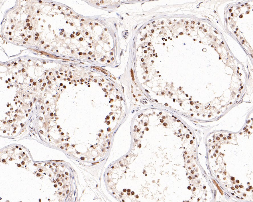 Immunohistochemical analysis of paraffin-embedded human testis tissue with Rabbit anti-TATA binding protein TBP antibody (HA500518) at 1/2,000 dilution.<br />
<br />
The section was pre-treated using heat mediated antigen retrieval with sodium citrate buffer (pH 6.0) for 2 minutes. The tissues were blocked in 1% BSA for 20 minutes at room temperature, washed with ddH2O and PBS, and then probed with the primary antibody (HA500518) at 1/2,000 dilution for 1 hour at room temperature. The detection was performed using an HRP conjugated compact polymer system. DAB was used as the chromogen. Tissues were counterstained with hematoxylin and mounted with DPX.