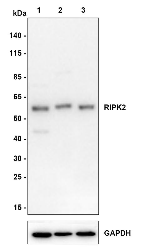 Western blot analysis of RIPK2 on different lysates with Rabbit anti-RIPK2 antibody (HA721300) at 1/500 dilution.<br />
<br />
Lane 1: PC-3M cell lysate<br />
Lane 2: 22RV1 cell lysate<br />
Lane 3: RWPE-1 cell lysate<br />
<br />
Lysates/proteins at 20 µg/Lane.<br />
<br />
Predicted band size: 61.2 kDa<br />
Observed band size: 61 kDa<br />
<br />
Exposure time: 2 minutes;<br />
<br />
4-20% SDS-PAGE gel.<br />
<br />
Proteins were transferred to a PVDF membrane and blocked with 5% NFDM/TBST for 1 hour at room temperature. The primary antibody (HA721300) at 1/500 dilution was used in 5% NFDM/TBST at room temperature for 2 hours. Goat Anti-Rabbit IgG - HRP Secondary Antibody (HA1001) at 1:200,000 dilution was used for 1 hour at room temperature.