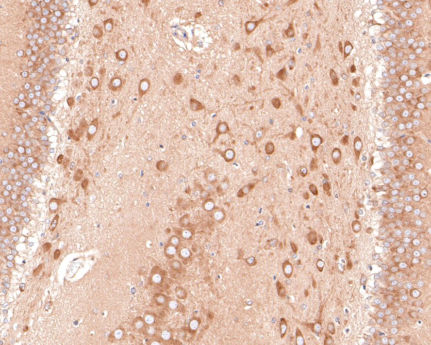 Immunohistochemical analysis of paraffin-embedded rat hippocampus tissue with Mouse anti-FAM38A/PIEZO1 antibody (M1005-2) at 1/600 dilution.<br />
<br />
The section was pre-treated using heat mediated antigen retrieval with Tris-EDTA buffer (pH 9.0) for 20 minutes. The tissues were blocked in 1% BSA for 20 minutes at room temperature, washed with ddH2O and PBS, and then probed with the primary antibody (M1005-2) at 1/600 dilution for 1 hour at room temperature. The detection was performed using an HRP conjugated compact polymer system. DAB was used as the chromogen. Tissues were counterstained with hematoxylin and mounted with DPX.