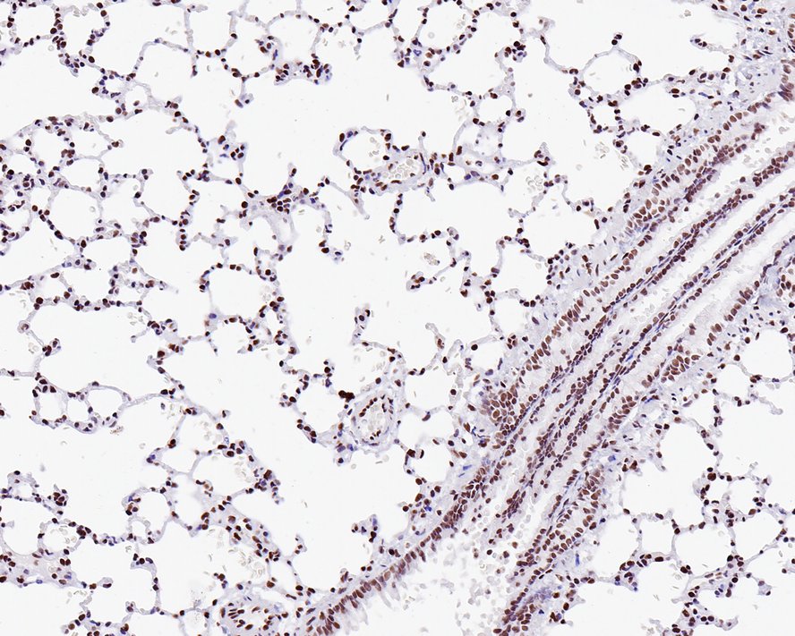 Immunohistochemical analysis of paraffin-embedded rat lung tissue with Rabbit anti-MBD2 antibody (ET7111-40) at 1/200 dilution.<br />
<br />
The section was pre-treated using heat mediated antigen retrieval with sodium citrate buffer (pH 6.0) for 2 minutes. The tissues were blocked in 1% BSA for 20 minutes at room temperature, washed with ddH2O and PBS, and then probed with the primary antibody (ET7111-40) at 1/200 dilution for 1 hour at room temperature. The detection was performed using an HRP conjugated compact polymer system. DAB was used as the chromogen. Tissues were counterstained with hematoxylin and mounted with DPX.