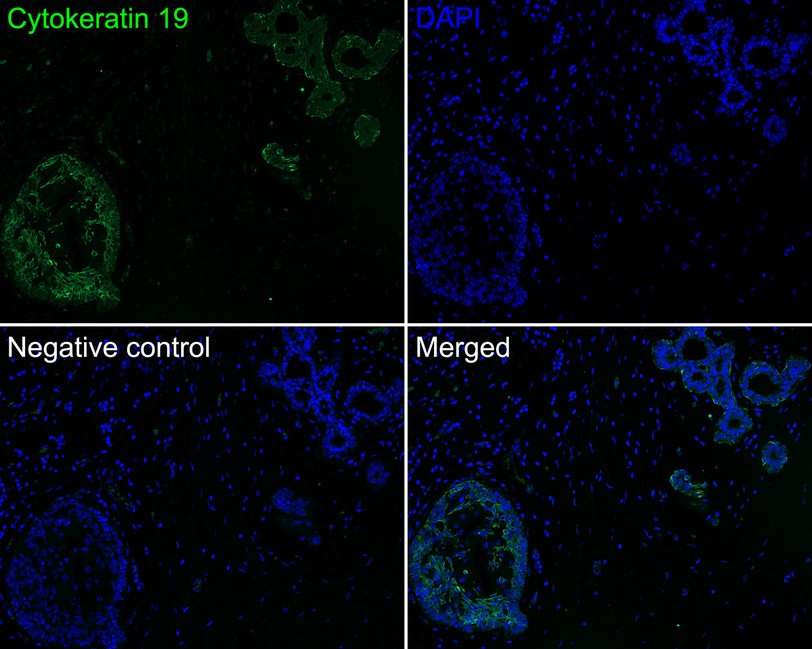 Immunofluorescence analysis of paraffin-embedded human breast tissue labeling Cytokeratin 19 (HA720140F).<br />
<br />
The section was pre-treated using heat mediated antigen retrieval with Tris-EDTA buffer (pH 9.0) for 20 minutes. The tissues were blocked in 10% negative goat serum for 1 hour at room temperature, washed with PBS. And then probed with the primary antibody Cytokeratin 19 (HA720140F, iFluor™ 488) at 1/100 dilution overnight at 4 ℃, washed with PBS. DAPI was used as nuclear counterstain.