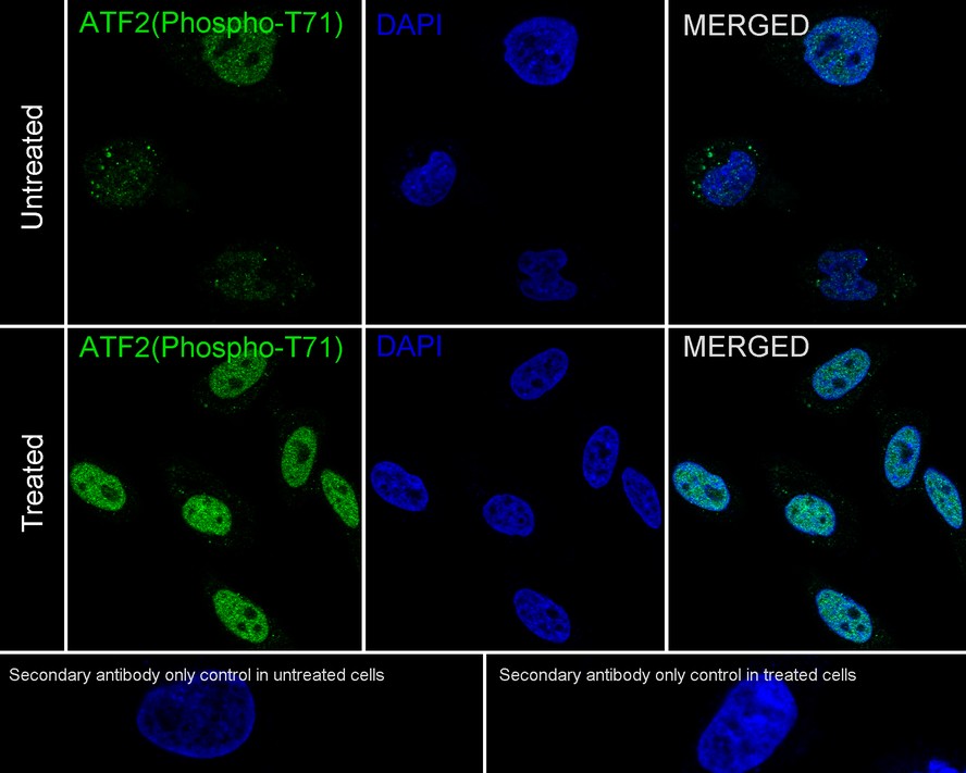 Immunocytochemistry analysis of Hela cells treated with or without 250ng/mL anisomycin for 30 minutes labeling Phospho-ATF2(T71) with Rabbit anti-Phospho-ATF2(T71) antibody (ET1610-30) at 1/50 dilution.<br />
<br />
Cells were fixed in 4% paraformaldehyde for 10 minutes at 37 ℃, permeabilized with 0.05% Triton X-100 in PBS for 20 minutes, and then blocked with 2% negative goat serum for 30 minutes at room temperature. Cells were then incubated with Rabbit anti-Phospho-ATF2(T71) antibody (ET1610-30) at 1/50 dilution in 2% negative goat serum overnight at 4 ℃. Goat Anti-Rabbit IgG H&L (iFluor™ 488, HA1121) was used as the secondary antibody at 1/1,000 dilution. PBS instead of the primary antibody was used as the secondary antibody only control. Nuclear DNA was labelled in blue with DAPI.