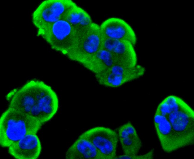 ICC staining of Insulin Receptor Beta in PANC-1 cells (green). Formalin fixed cells were permeabilized with 0.1% Triton X-100 in TBS for 10 minutes at room temperature and blocked with 1% Blocker BSA for 15 minutes at room temperature. Cells were probed with the primary antibody (ET1611-90, 1/50) for 1 hour at room temperature, washed with PBS. Alexa Fluor®488 Goat anti-Rabbit IgG was used as the secondary antibody at 1/1,000 dilution. The nuclear counter stain is DAPI (blue).