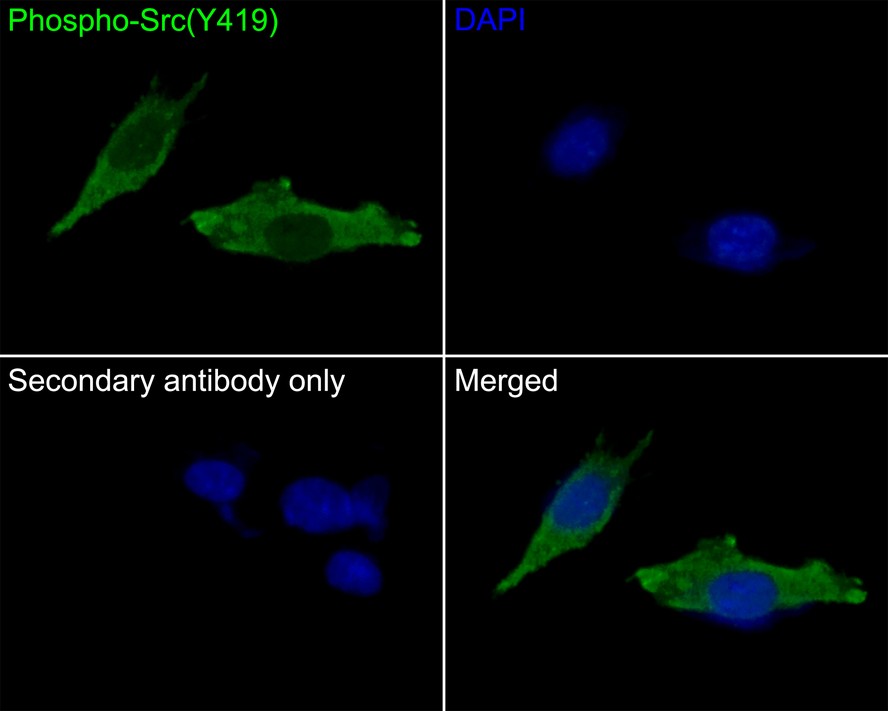 Immunocytochemistry analysis of SH-SY5Y cells labeling Phospho-Src(Y419) with Rabbit anti-Phospho-Src(Y419) antibody (ET1609-15) at 1/50 dilution.<br />
<br />
Cells were fixed in 4% paraformaldehyde for 10 minutes at 37 ℃, permeabilized with 0.05% Triton X-100 in PBS for 20 minutes, and then blocked with 2% negative goat serum for 30 minutes at room temperature. Cells were then incubated with Rabbit anti-Phospho-Src(Y419) antibody (ET1609-15) at 1/50 dilution in 2% negative goat serum overnight at 4 ℃. Goat Anti-Rabbit IgG H&L (iFluor™ 488, HA1121) was used as the secondary antibody at 1/1,000 dilution. PBS instead of the primary antibody was used as the secondary antibody only control. Nuclear DNA was labelled in blue with DAPI.