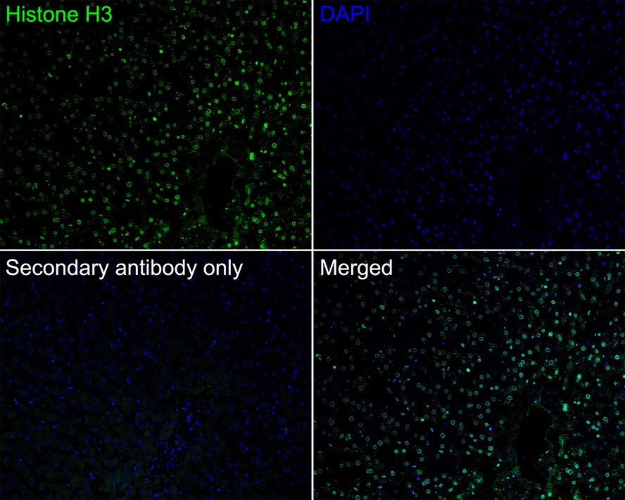 Immunohistochemical analysis of paraffin-embedded human skin tissue with Rabbit anti-Histone H3 antibody (ET1701-64) at 1/5,000 dilution.<br />
<br />
The section was pre-treated using heat mediated antigen retrieval with sodium citrate buffer (pH 6.0) for 2 minutes. The tissues were blocked in 1% BSA for 20 minutes at room temperature, washed with ddH2O and PBS, and then probed with the primary antibody (ET1701-64) at 1/5,000 dilution for 1 hour at room temperature. The detection was performed using an HRP conjugated compact polymer system. DAB was used as the chromogen. Tissues were counterstained with hematoxylin and mounted with DPX.
