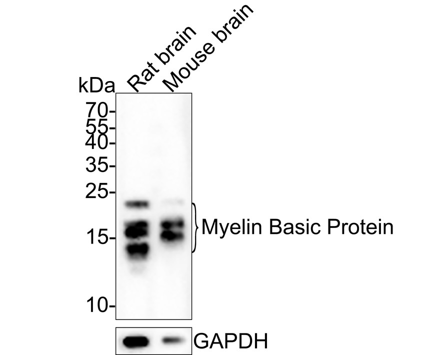 Western blot analysis of Myelin Basic Protein on different lysates with Rabbit anti-Myelin Basic Protein antibody (ET1702-15) at 1/500 dilution.<br />
<br />
Lane 1: Rat brain tissue lysate<br />
Lane 2: Mouse brain tissue lysate<br />
<br />
Lysates/proteins at 20 µg/Lane.<br />
<br />
Predicted band size: 33 kDa<br />
Observed band size: 14~25 kDa<br />
<br />
Exposure time: 2 minutes;<br />
<br />
15% SDS-PAGE gel.<br />
<br />
Proteins were transferred to a PVDF membrane and blocked with 5% NFDM/TBST for 1 hour at room temperature. The primary antibody (ET1702-15) at 1/500 dilution was used in 5% NFDM/TBST at room temperature for 2 hours. Goat Anti-Rabbit IgG - HRP Secondary Antibody (HA1001) at 1:200,000 dilution was used for 1 hour at room temperature.