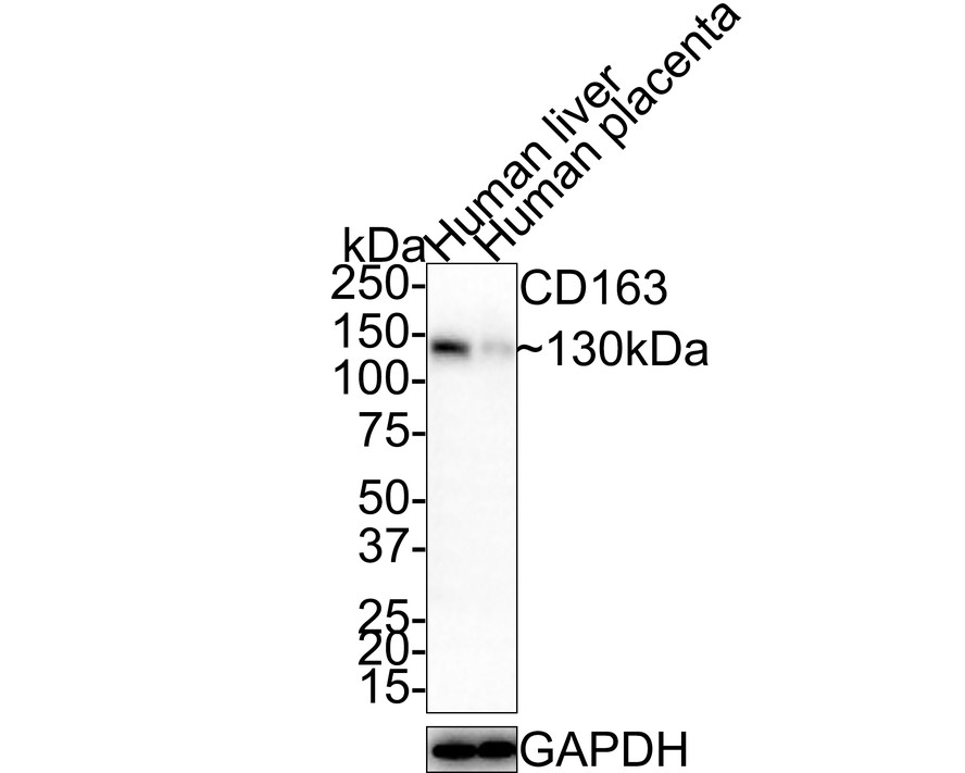 Western blot analysis of CD163 on different lysates with Rabbit anti-CD163 antibody (ER1902-09) at 1/1,000 dilution.<br />
<br />
Lane 1: Human liver tissue lysate<br />
Lane 2: Human placenta tissue lysate<br />
<br />
Lysates/proteins at 20 µg/Lane.<br />
<br />
Predicted band size: 125 kDa<br />
Observed band size: 130 kDa<br />
<br />
Exposure time: 1 minute;<br />
<br />
4-20% SDS-PAGE gel.<br />
<br />
Proteins were transferred to a PVDF membrane and blocked with 5% NFDM/TBST for 1 hour at room temperature. The primary antibody (ER1902-09) at 1/1,000 dilution was used in 5% NFDM/TBST at room temperature for 2 hours. Goat Anti-Rabbit IgG - HRP Secondary Antibody (HA1001) at 1:200,000 dilution was used for 1 hour at room temperature.