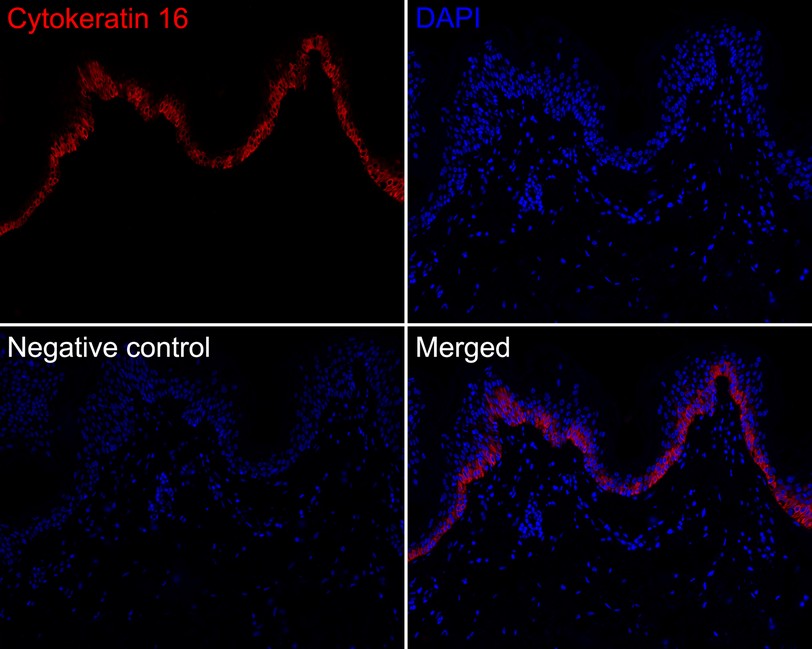 Immunofluorescence analysis of paraffin-embedded human skin tissue labeling Cytokeratin 16.<br />
The section was pre-treated using heat mediated antigen retrieval with Tris-EDTA buffer (pH 9.0) for 20 minutes. The tissues were blocked in 10% negative goat serum for 1 hour at room temperature, washed with PBS. The section was then incubated overnight at +4℃ with HA720114F Cytokeratin 16 (iFluor™ 594, red) at 1/100 dilution, washed with PBS. DAPI was used as nuclear counterstain.