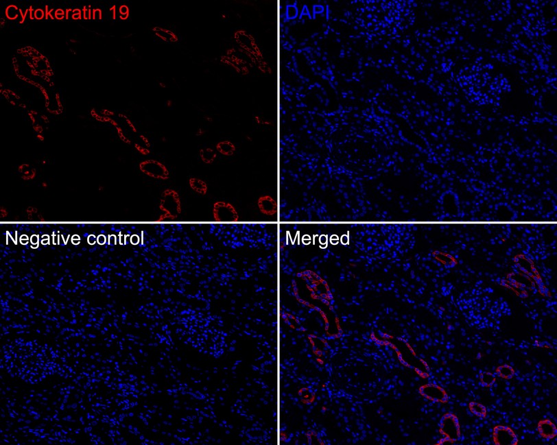 Immunofluorescence analysis of paraffin-embedded human kidney tissue labeling Cytokeratin 19 (HA720115F).<br />
<br />
The section was pre-treated using heat mediated antigen retrieval with Tris-EDTA buffer (pH 9.0) for 20 minutes. The tissues were blocked in 10% negative goat serum for 1 hour at room temperature, washed with PBS. And then probed with the primary antibody Cytokeratin 19 (HA720115F, iFluor™ 594) at 1/100 dilution overnight at 4 ℃, washed with PBS. DAPI was used as nuclear counterstain.