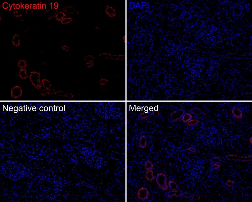 Immunofluorescence analysis of paraffin-embedded human kidney tissue labeling Cytokeratin 19 (HA720152F).<br />
<br />
The section was pre-treated using heat mediated antigen retrieval with Tris-EDTA buffer (pH 9.0) for 20 minutes. The tissues were blocked in 10% negative goat serum for 1 hour at room temperature, washed with PBS. And then probed with the primary antibody Cytokeratin 19 (HA720152F, iFluor™ 647) at 1/100 dilution overnight at 4 ℃, washed with PBS. DAPI was used as nuclear counterstain.