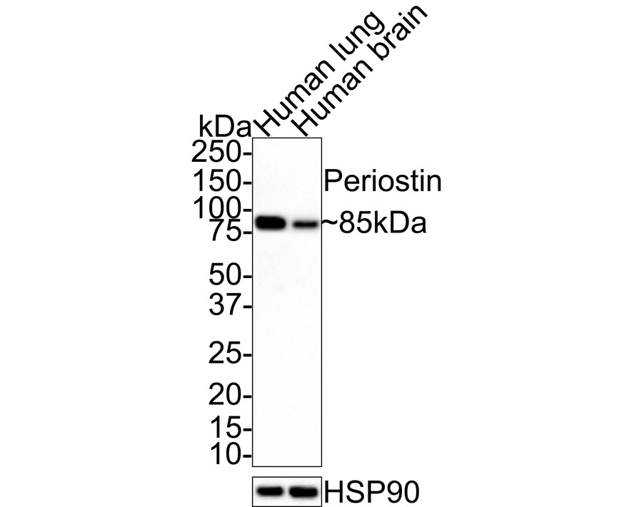 Western blot analysis of Periostin on different lysates with Rabbit anti-Periostin antibody (ET1704-65) at 1/1,000 dilution.<br />
<br />
Lane 1: Human lung tissue lysate<br />
Lane 2: Human brain tissue lysate<br />
<br />
Lysates/proteins at 30 µg/Lane.<br />
<br />
Predicted band size: 93 kDa<br />
Observed band size: 85 kDa<br />
<br />
Exposure time: 3 minutes;<br />
<br />
4-20% SDS-PAGE gel.<br />
<br />
Proteins were transferred to a PVDF membrane and blocked with 5% NFDM/TBST for 1 hour at room temperature. The primary antibody (ET1704-65) at 1/1,000 dilution was used in 5% NFDM/TBST at room temperature for 2 hours. Goat Anti-Rabbit IgG - HRP Secondary Antibody (HA1001) at 1:100,000 dilution was used for 1 hour at room temperature.