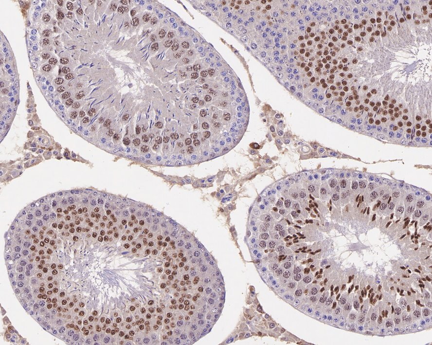 Immunohistochemical analysis of paraffin-embedded rat testis tissue with Mouse anti-Cyclin E2 antibody (M0407-15) at 1/200 dilution.<br />
<br />
The section was pre-treated using heat mediated antigen retrieval with sodium citrate buffer (pH 6.0) for 2 minutes. The tissues were blocked in 1% BSA for 20 minutes at room temperature, washed with ddH2O and PBS, and then probed with the primary antibody (M0407-15) at 1/200 dilution for 1 hour at room temperature. The detection was performed using an HRP conjugated compact polymer system. DAB was used as the chromogen. Tissues were counterstained with hematoxylin and mounted with DPX.