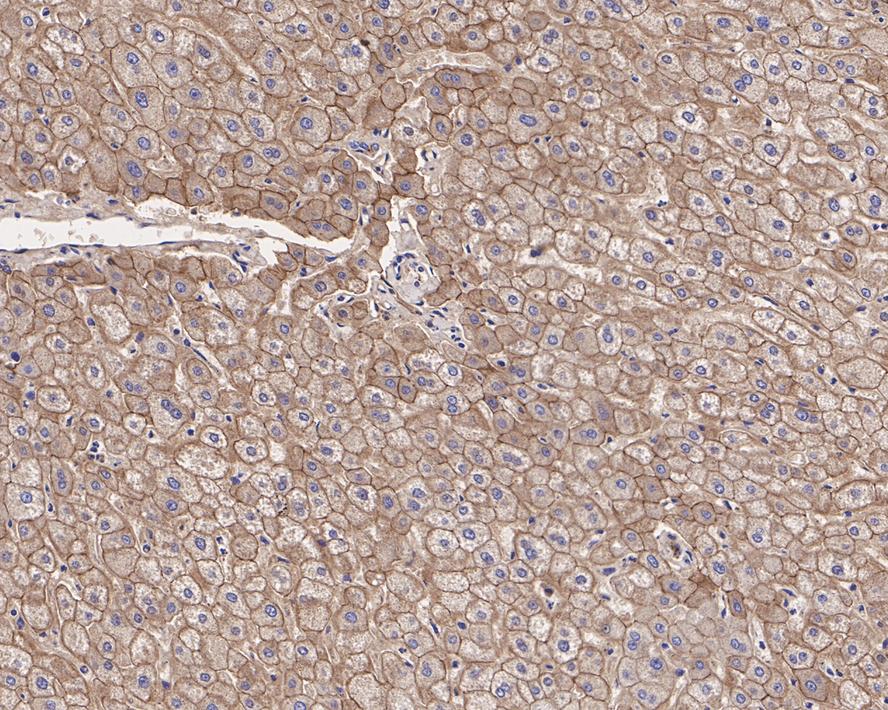 Immunohistochemical analysis of paraffin-embedded human liver tissue with Mouse anti-E-cadherin antibody (M1405-3) at 1/200 dilution.<br />
<br />
The section was pre-treated using heat mediated antigen retrieval with Tris-EDTA buffer (pH 9.0) for 20 minutes. The tissues were blocked in 1% BSA for 20 minutes at room temperature, washed with ddH2O and PBS, and then probed with the primary antibody (M1405-3) at 1/200 dilution for 1 hour at room temperature. The detection was performed using an HRP conjugated compact polymer system. DAB was used as the chromogen. Tissues were counterstained with hematoxylin and mounted with DPX.