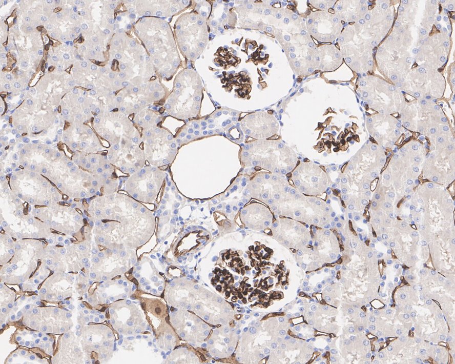 Immunohistochemical analysis of paraffin-embedded rat cerebellum tissue with Rabbit anti-CD34 antibody (ET1606-11) at 1/10,000 dilution.<br />
<br />
The section was pre-treated using heat mediated antigen retrieval with Tris-EDTA buffer (pH 9.0) for 20 minutes. The tissues were blocked in 1% BSA for 20 minutes at room temperature, washed with ddH2O and PBS, and then probed with the primary antibody (ET1606-11) at 1/10,000 dilution for 1 hour at room temperature. The detection was performed using an HRP conjugated compact polymer system. DAB was used as the chromogen. Tissues were counterstained with hematoxylin and mounted with DPX.