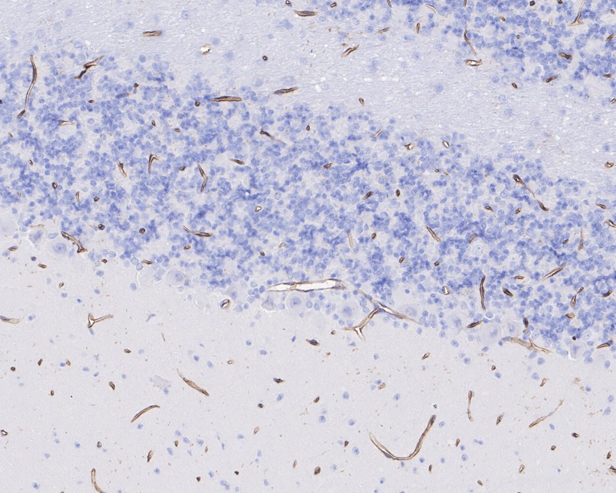 Immunohistochemical analysis of paraffin-embedded rat cerebral cortex tissue with Rabbit anti-CD34 antibody (ET1606-11) at 1/10,000 dilution.<br />
<br />
The section was pre-treated using heat mediated antigen retrieval with Tris-EDTA buffer (pH 9.0) for 20 minutes. The tissues were blocked in 1% BSA for 20 minutes at room temperature, washed with ddH2O and PBS, and then probed with the primary antibody (ET1606-11) at 1/10,000 dilution for 1 hour at room temperature. The detection was performed using an HRP conjugated compact polymer system. DAB was used as the chromogen. Tissues were counterstained with hematoxylin and mounted with DPX.