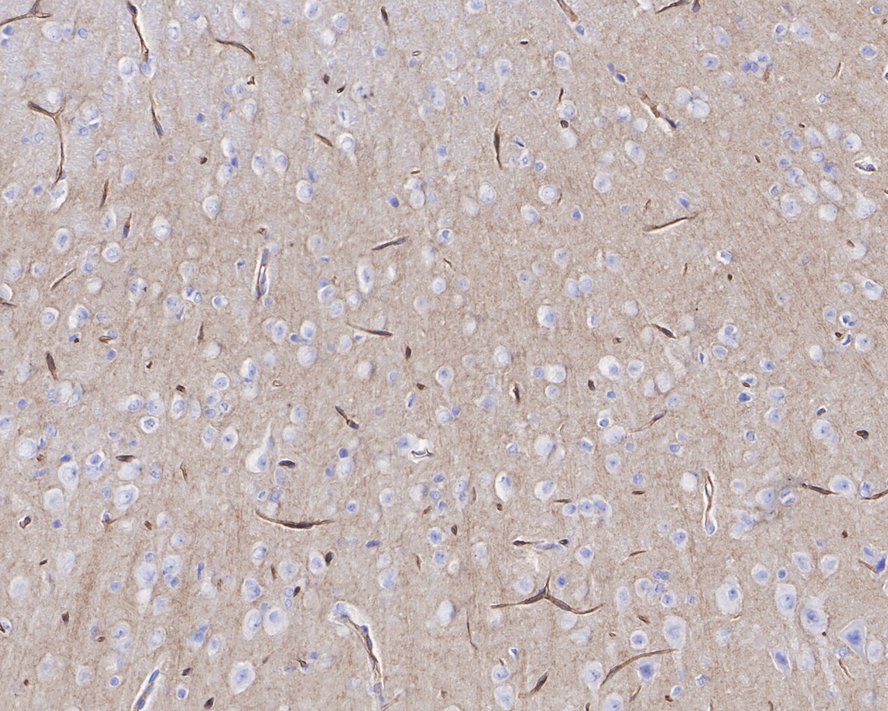 Immunohistochemical analysis of paraffin-embedded rat hippocampus tissue with Rabbit anti-CD34 antibody (ET1606-11) at 1/10,000 dilution.<br />
<br />
The section was pre-treated using heat mediated antigen retrieval with Tris-EDTA buffer (pH 9.0) for 20 minutes. The tissues were blocked in 1% BSA for 20 minutes at room temperature, washed with ddH2O and PBS, and then probed with the primary antibody (ET1606-11) at 1/10,000 dilution for 1 hour at room temperature. The detection was performed using an HRP conjugated compact polymer system. DAB was used as the chromogen. Tissues were counterstained with hematoxylin and mounted with DPX.