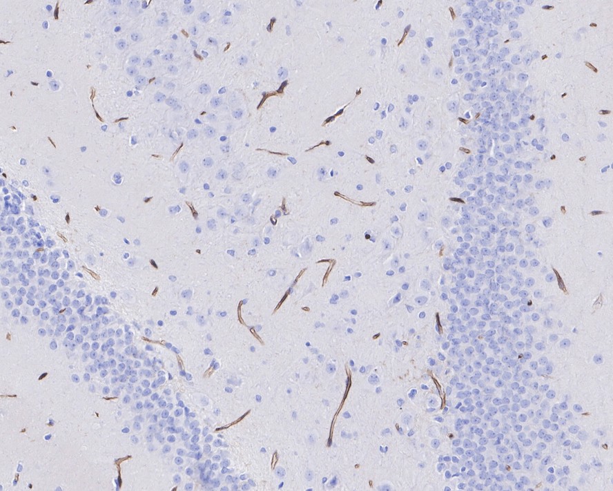 Immunohistochemical analysis of paraffin-embedded mouse cerebellum tissue with Rabbit anti-CD34 antibody (ET1606-11) at 1/10,000 dilution.<br />
<br />
The section was pre-treated using heat mediated antigen retrieval with Tris-EDTA buffer (pH 9.0) for 20 minutes. The tissues were blocked in 1% BSA for 20 minutes at room temperature, washed with ddH2O and PBS, and then probed with the primary antibody (ET1606-11) at 1/10,000 dilution for 1 hour at room temperature. The detection was performed using an HRP conjugated compact polymer system. DAB was used as the chromogen. Tissues were counterstained with hematoxylin and mounted with DPX.