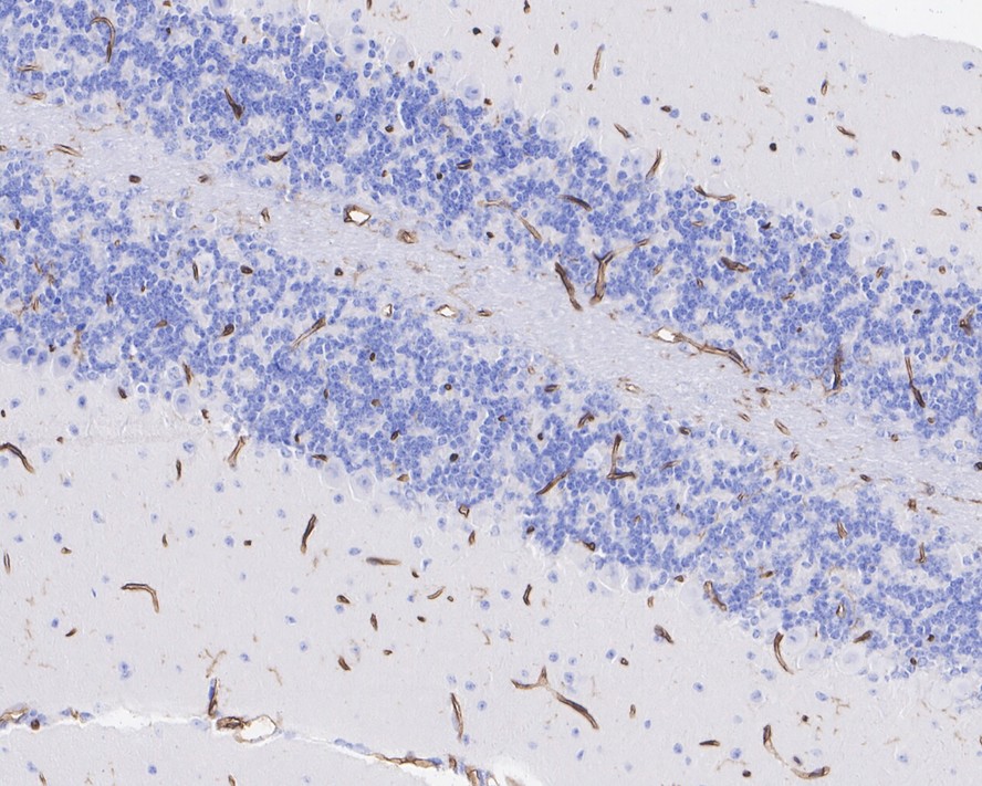 Immunohistochemical analysis of paraffin-embedded mouse cerebral cortex tissue with Rabbit anti-CD34 antibody (ET1606-11) at 1/10,000 dilution.<br />
<br />
The section was pre-treated using heat mediated antigen retrieval with Tris-EDTA buffer (pH 9.0) for 20 minutes. The tissues were blocked in 1% BSA for 20 minutes at room temperature, washed with ddH2O and PBS, and then probed with the primary antibody (ET1606-11) at 1/10,000 dilution for 1 hour at room temperature. The detection was performed using an HRP conjugated compact polymer system. DAB was used as the chromogen. Tissues were counterstained with hematoxylin and mounted with DPX.