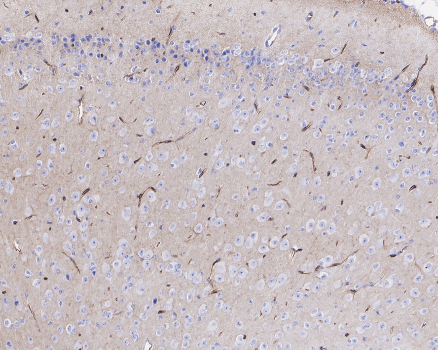 Immunohistochemical analysis of paraffin-embedded mouse hippocampus tissue with Rabbit anti-CD34 antibody (ET1606-11) at 1/10,000 dilution.<br />
<br />
The section was pre-treated using heat mediated antigen retrieval with Tris-EDTA buffer (pH 9.0) for 20 minutes. The tissues were blocked in 1% BSA for 20 minutes at room temperature, washed with ddH2O and PBS, and then probed with the primary antibody (ET1606-11) at 1/10,000 dilution for 1 hour at room temperature. The detection was performed using an HRP conjugated compact polymer system. DAB was used as the chromogen. Tissues were counterstained with hematoxylin and mounted with DPX.
