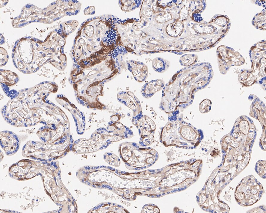 Immunohistochemical analysis of paraffin-embedded human placenta tissue with Rabbit anti-PDLIM1 antibody (ET7110-99) at 1/1,000 dilution.<br />
<br />
The section was pre-treated using heat mediated antigen retrieval with Tris-EDTA buffer (pH 9.0) for 20 minutes. The tissues were blocked in 1% BSA for 20 minutes at room temperature, washed with ddH2O and PBS, and then probed with the primary antibody (ET7110-99) at 1/1,000 dilution for 1 hour at room temperature. The detection was performed using an HRP conjugated compact polymer system. DAB was used as the chromogen. Tissues were counterstained with hematoxylin and mounted with DPX.