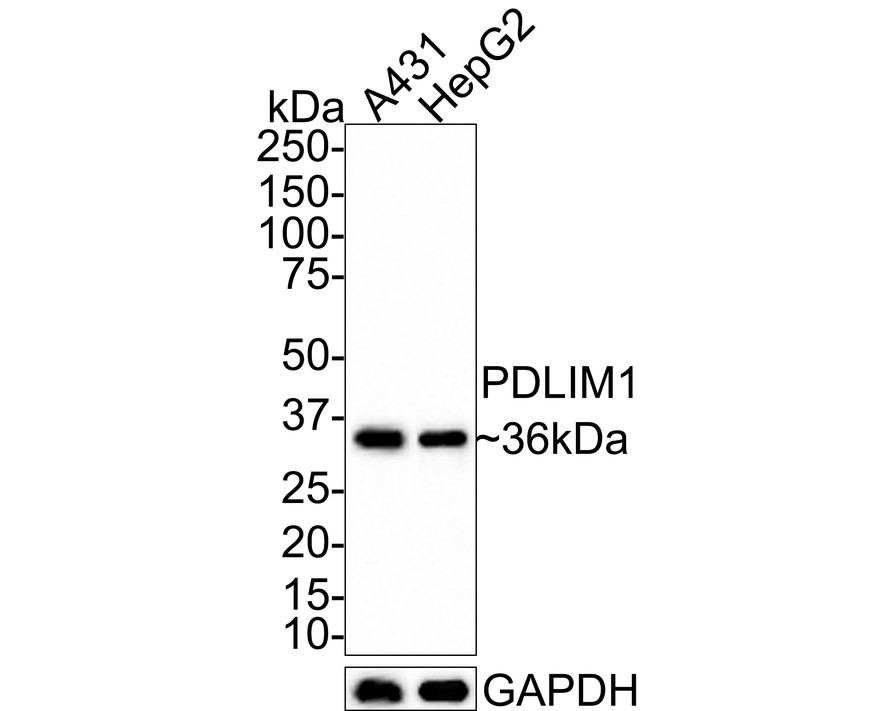 Western blot analysis of PDLIM1 on different lysates with Rabbit anti-PDLIM1 antibody (ET7110-99) at 1/1,000 dilution.<br />
<br />
Lane 1: A431 cell lysate<br />
Lane 2: A431 cell lysate<br />
<br />
Lysates/proteins at 10 µg/Lane.<br />
<br />
Predicted band size: 36 kDa<br />
Observed band size: 36 kDa<br />
<br />
Exposure time: 3 minutes;<br />
<br />
4-20% SDS-PAGE gel.<br />
<br />
Proteins were transferred to a PVDF membrane and blocked with 5% NFDM/TBST for 1 hour at room temperature. The primary antibody (ET7110-99) at 1/1,000 dilution was used in 5% NFDM/TBST at room temperature for 2 hours. Goat Anti-Rabbit IgG - HRP Secondary Antibody (HA1001) at 1:100,000 dilution was used for 1 hour at room temperature.