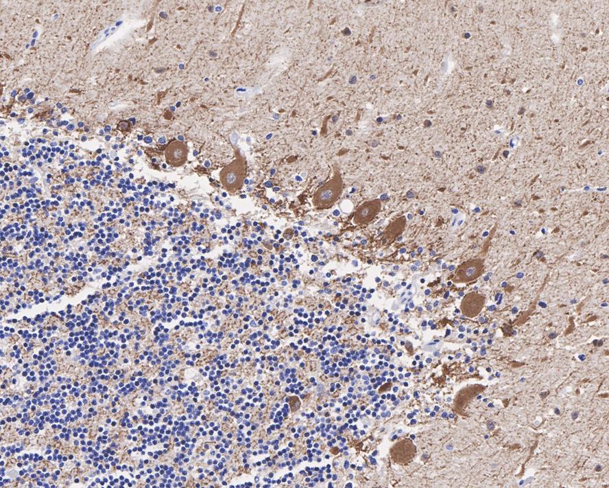 Immunohistochemical analysis of paraffin-embedded human cerebellum tissue with Rabbit anti-GAD67 antibody (ET1703-71) at 1/200 dilution.<br />
<br />
The section was pre-treated using heat mediated antigen retrieval with Tris-EDTA buffer (pH 9.0) for 20 minutes. The tissues were blocked in 1% BSA for 20 minutes at room temperature, washed with ddH2O and PBS, and then probed with the primary antibody (ET1703-71) at 1/200 dilution for 1 hour at room temperature. The detection was performed using an HRP conjugated compact polymer system. DAB was used as the chromogen. Tissues were counterstained with hematoxylin and mounted with DPX.