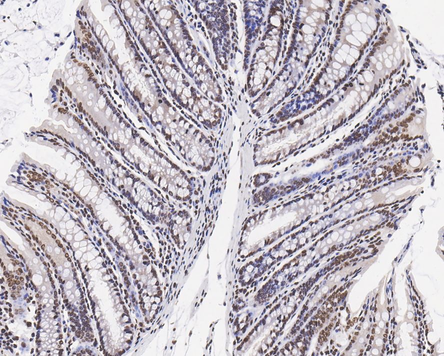 Immunohistochemical analysis of paraffin-embedded mouse colon tissue with Rabbit anti-Histone H3 (mono+di+tri methyl K79) antibody (ET1602-41) at 1/5,000 dilution.<br />
<br />
The section was pre-treated using heat mediated antigen retrieval with sodium citrate buffer (pH 6.0) for 2 minutes. The tissues were blocked in 1% BSA for 20 minutes at room temperature, washed with ddH2O and PBS, and then probed with the primary antibody (ET1602-41) at 1/5,000 dilution for 1 hour at room temperature. The detection was performed using an HRP conjugated compact polymer system. DAB was used as the chromogen. Tissues were counterstained with hematoxylin and mounted with DPX.