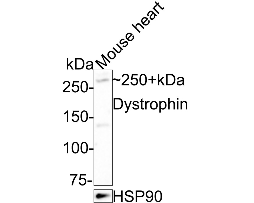 Western blot analysis of Dystrophin on mouse heart tissue lysates with Rabbit anti-Dystrophin antibody (ET1702-98) at 1/1,000 dilution.<br />
<br />
Lysates/proteins at 20 µg/Lane.<br />
<br />
Predicted band size: 427 kDa<br />
Observed band size: 250+ kDa<br />
<br />
Exposure time: 3 minutes;<br />
<br />
6% SDS-PAGE gel.<br />
<br />
Proteins were transferred to a PVDF membrane and blocked with 5% NFDM/TBST for 1 hour at room temperature. The primary antibody (ET1702-98) at 1/1,000 dilution was used in 5% NFDM/TBST at room temperature for 2 hours. Goat Anti-Rabbit IgG - HRP Secondary Antibody (HA1001) at 1:100,000 dilution was used for 1 hour at room temperature.
