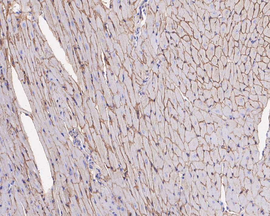 Immunohistochemical analysis of paraffin-embedded mouse heart tissue with Rabbit anti-Dystrophin antibody (ET1702-98) at 1/1,000 dilution.<br />
<br />
The section was pre-treated using heat mediated antigen retrieval with sodium citrate buffer (pH 6.0) for 2 minutes. The tissues were blocked in 1% BSA for 20 minutes at room temperature, washed with ddH2O and PBS, and then probed with the primary antibody (ET1702-98) at 1/1,000 dilution for 1 hour at room temperature. The detection was performed using an HRP conjugated compact polymer system. DAB was used as the chromogen. Tissues were counterstained with hematoxylin and mounted with DPX.
