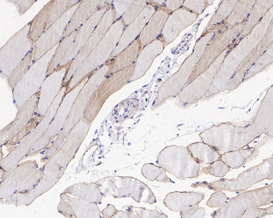 Immunohistochemical analysis of paraffin-embedded rat skeletal muscle tissue with Rabbit anti-Dystrophin antibody (ET1702-98) at 1/1,000 dilution.<br />
<br />
The section was pre-treated using heat mediated antigen retrieval with sodium citrate buffer (pH 6.0) for 2 minutes. The tissues were blocked in 1% BSA for 20 minutes at room temperature, washed with ddH2O and PBS, and then probed with the primary antibody (ET1702-98) at 1/1,000 dilution for 1 hour at room temperature. The detection was performed using an HRP conjugated compact polymer system. DAB was used as the chromogen. Tissues were counterstained with hematoxylin and mounted with DPX.