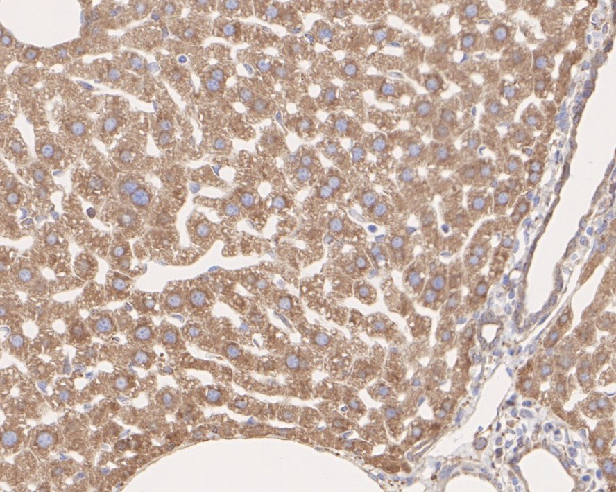 Immunohistochemical analysis of paraffin-embedded mouse jawbone tissue with Rabbit anti-Alkaline Phosphatase antibody (ET1601-21) at 1/200 dilution.<br />
<br />
The section was pre-treated using heat mediated antigen retrieval with Tris-EDTA buffer (pH 9.0) for 20 minutes. The tissues were blocked in 1% BSA for 20 minutes at room temperature, washed with ddH2O and PBS, and then probed with the primary antibody (ET1601-21) at 1/200 dilution for 1 hour at room temperature. The detection was performed using an HRP conjugated compact polymer system. DAB was used as the chromogen. Tissues were counterstained with hematoxylin and mounted with DPX.