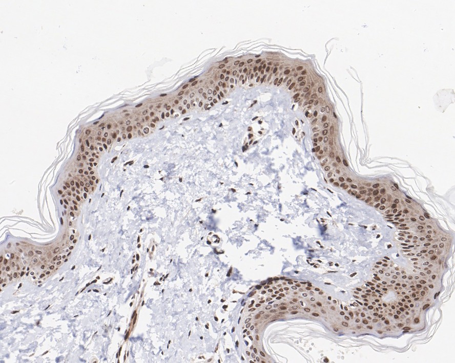 Immunohistochemical analysis of paraffin-embedded human kidney tissue with Rabbit anti-Histone H3 (mono methyl R2) antibody (ET1609-8) at 1/200 dilution.<br />
<br />
The section was pre-treated using heat mediated antigen retrieval with sodium citrate buffer (pH 6.0) for 2 minutes. The tissues were blocked in 1% BSA for 20 minutes at room temperature, washed with ddH2O and PBS, and then probed with the primary antibody (ET1609-8) at 1/200 dilution for 1 hour at room temperature. The detection was performed using an HRP conjugated compact polymer system. DAB was used as the chromogen. Tissues were counterstained with hematoxylin and mounted with DPX.