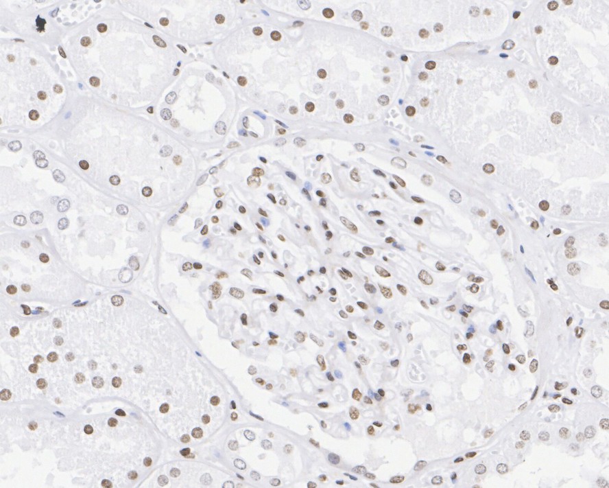 Immunohistochemical analysis of paraffin-embedded human skin tissue with Rabbit anti-Histone H3 (mono methyl R2) antibody (ET1609-8) at 1/200 dilution.<br />
<br />
The section was pre-treated using heat mediated antigen retrieval with sodium citrate buffer (pH 6.0) for 2 minutes. The tissues were blocked in 1% BSA for 20 minutes at room temperature, washed with ddH2O and PBS, and then probed with the primary antibody (ET1609-8) at 1/200 dilution for 1 hour at room temperature. The detection was performed using an HRP conjugated compact polymer system. DAB was used as the chromogen. Tissues were counterstained with hematoxylin and mounted with DPX.