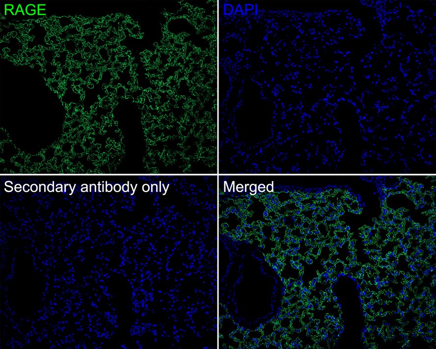 Immunofluorescence analysis of paraffin-embedded mouse lung tissue (perfusion) labeling RAGE with Rabbit anti-RAGE antibody (ET1702-27) at 1/100 dilution.<br />
<br />
The section was pre-treated using heat mediated antigen retrieval with Tris-EDTA buffer (pH 9.0) for 20 minutes. The tissues were blocked in 10% negative goat serum for 1 hour at room temperature, washed with PBS, and then probed with the primary antibody (ET1702-27, green) at 1/100 dilution overnight at 4 ℃, washed with PBS.<br />
<br />
Goat Anti-Rabbit IgG H&L (iFluor™ 488, HA1121) was used as the secondary antibody at 1/1,000 dilution. Nuclei were counterstained with DAPI (blue).