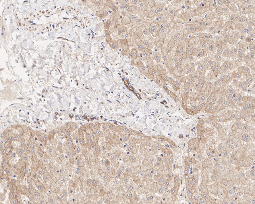 Immunohistochemical analysis of paraffin-embedded mouse brain tissue using anti-beta 2 Adrenergic Receptor antibody. The section was pre-treated using heat mediated antigen retrieval with Tris-EDTA buffer (pH 8.0-8.4) for 20 minutes.The tissues were blocked in 5% BSA for 30 minutes at room temperature, washed with ddH2O and PBS, and then probed with the primary antibody (ET1703-04, 1/50) for 30 minutes at room temperature. The detection was performed using an HRP conjugated compact polymer system. DAB was used as the chromogen. Tissues were counterstained with hematoxylin and mounted with DPX.
