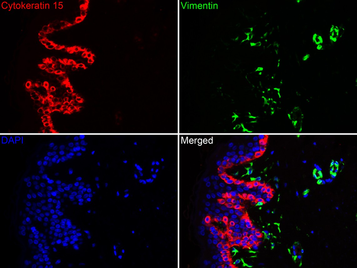 Immunofluorescence analysis of paraffin-embedded human skin tissue labeling Cytokeratin 15 (ET1609-54) and Vimentin (EM0401).<br />
<br />
The section was pre-treated using heat mediated antigen retrieval with Tris-EDTA buffer (pH 9.0) for 20 minutes. The tissues were blocked in 10% negative goat serum for 1 hour at room temperature, washed with PBS. And then probed with the primary antibodies Cytokeratin 15 (ET1609-54, red) at 1/400 dilution and Vimentin (EM0401, green) at 1/400 dilution at +4℃ overnight, washed with PBS.<br />
<br />
Goat Anti-Rabbit IgG H&L (iFluor™ 594, HA1122) and Goat Anti-Mouse IgG H&L (iFluor™ 488, HA1125) were used as the secondary antibodies at 1/1,000 dilution. Nuclei were counterstained with DAPI (blue).