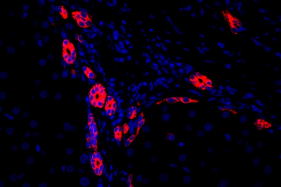 Flow cytometric analysis of Cytokeratin 7 was done on Hela cells. The cells were fixed, permeabilized and stained with the primary antibody (ET1609-62, 1/50) (red). After incubation of the primary antibody at room temperature for an hour, the cells were stained with a Alexa Fluor 488-conjugated Goat anti-Rabbit IgG Secondary antibody at 1/1000 dilution for 30 minutes.Unlabelled sample was used as a control (cells without incubation with primary antibody; black).