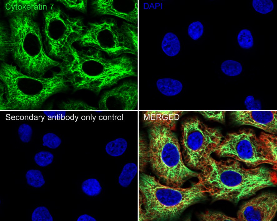 Immunofluorescence analysis of paraffin-embedded human breast tissue labeling Cytokeratin 7 (ET1609-62).<br />
<br />
The section was pre-treated using heat mediated antigen retrieval with Tris-EDTA buffer (pH 9.0) for 20 minutes. The tissues were blocked in 10% negative goat serum for 1 hour at room temperature, washed with PBS. And then probed with the primary antibodies Cytokeratin 7 (ET1609-62, red) at 1/400 dilution at +4℃ overnight, washed with PBS.<br />
<br />
Goat Anti-Rabbit IgG H&L (iFluor™ 594, HA1122) was used as the secondary antibodies at 1/1,000 dilution. Nuclei were counterstained with DAPI (blue).