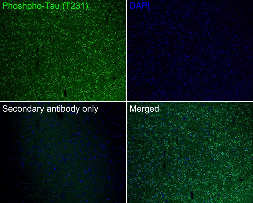 Immunofluorescence analysis of paraffin-embedded mouse brain tissue labeling Phospho-Tau(T231) with Rabbit anti-Phospho-Tau(T231) antibody (ET1610-31) at 1/200 dilution.<br />
<br />
The section was pre-treated using heat mediated antigen retrieval with Tris-EDTA buffer (pH 9.0) for 20 minutes. The tissues were blocked in 10% negative goat serum for 1 hour at room temperature, washed with PBS, and then probed with the primary antibody (ET1610-31, green) at 1/200 dilution overnight at 4 ℃, washed with PBS.<br />
<br />
Goat Anti-Rabbit IgG H&L (iFluor™ 488, HA1121) was used as the secondary antibody at 1/1,000 dilution. Nuclei were counterstained with DAPI (blue).