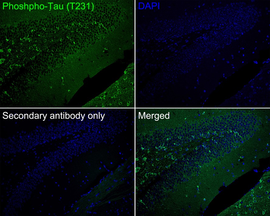 Immunofluorescence analysis of paraffin-embedded mouse hippocampus tissue labeling Phospho-Tau(T231) with Rabbit anti-Phospho-Tau(T231) antibody (ET1610-31) at 1/200 dilution.<br />
<br />
The section was pre-treated using heat mediated antigen retrieval with Tris-EDTA buffer (pH 9.0) for 20 minutes. The tissues were blocked in 10% negative goat serum for 1 hour at room temperature, washed with PBS, and then probed with the primary antibody (ET1610-31, green) at 1/200 dilution overnight at 4 ℃, washed with PBS.<br />
<br />
Goat Anti-Rabbit IgG H&L (iFluor™ 488, HA1121) was used as the secondary antibody at 1/1,000 dilution. Nuclei were counterstained with DAPI (blue).