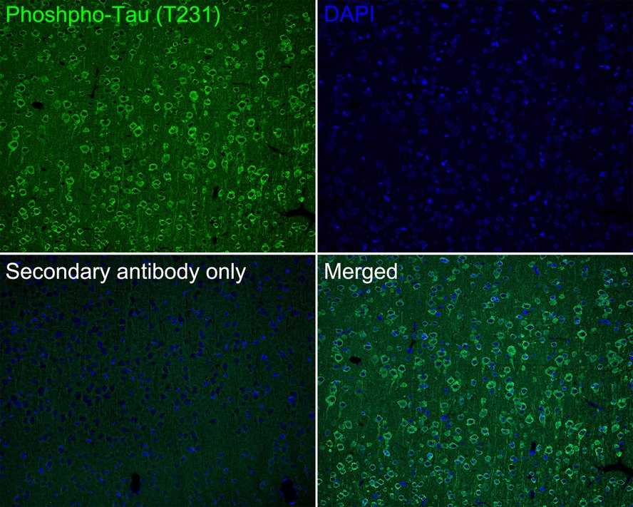 Immunofluorescence analysis of paraffin-embedded rat brain tissue labeling Phospho-Tau(T231) with Rabbit anti-Phospho-Tau(T231) antibody (ET1610-31) at 1/200 dilution.<br />
<br />
The section was pre-treated using heat mediated antigen retrieval with Tris-EDTA buffer (pH 9.0) for 20 minutes. The tissues were blocked in 10% negative goat serum for 1 hour at room temperature, washed with PBS, and then probed with the primary antibody (ET1610-31, green) at 1/200 dilution overnight at 4 ℃, washed with PBS.<br />
<br />
Goat Anti-Rabbit IgG H&L (iFluor™ 488, HA1121) was used as the secondary antibody at 1/1,000 dilution. Nuclei were counterstained with DAPI (blue).