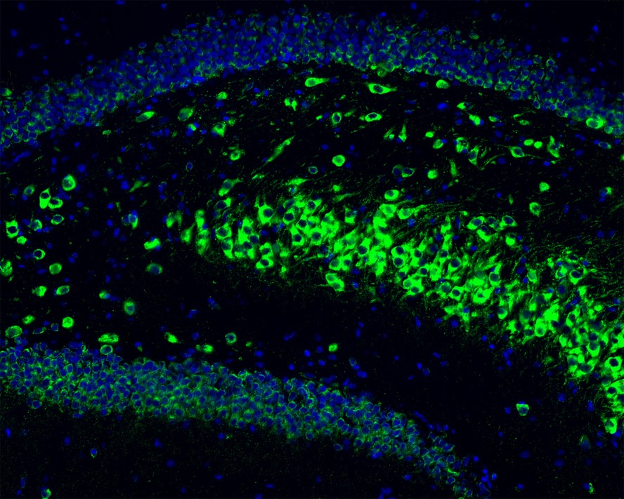 Immunofluorescence analysis of frozen mouse hippocampus tissue labeling Phospho-Tau(T231) with Rabbit anti-Phospho-Tau(T231) antibody (ET1610-31).<br />
The tissues were blocked in 3% BSA for 30 minutes at room temperature, washed with PBS, and then probed with the primary antibody (ET1610-31, green) at 1/100 dilution overnight at 4℃, washed with PBS. Goat Anti-Rabbit IgG H&L (Alexa Fluor® 488) was used as the secondary antibody at 1/200 dilution. Nuclei were counterstained with DAPI (blue). Image acquisition was performed with KFBIO KF-FL-400 Scanner.